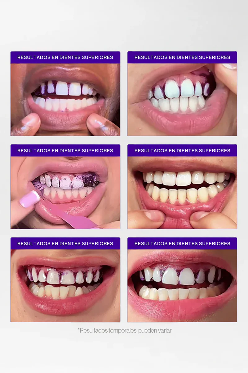 PURPLE STRIPS V34 - Tiras blanqueadoras