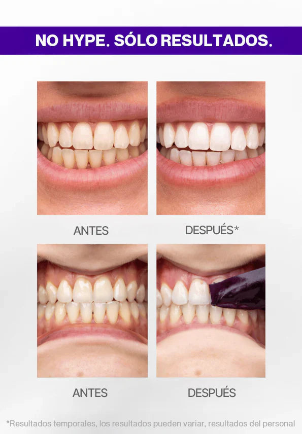 PURPLE STRIPS V34 - Tiras blanqueadoras